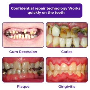 🦷Dobshow® Dental Repair Mineral Powder >> 🔥Buy 1 Get 1 Free🔥