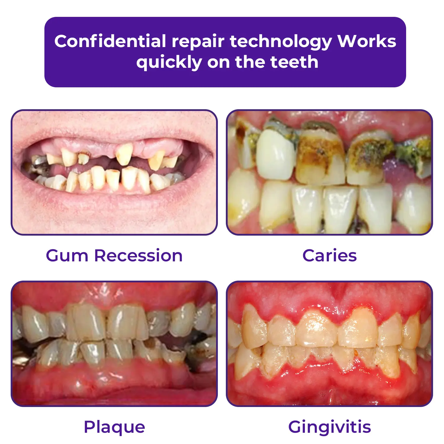 🦷Dobshow® Dental Repair Mineral Powder >> 🔥Buy 1 Get 1 Free🔥