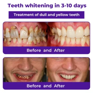 🦷Dobshow® Dental Repair Mineral Powder >> 🔥Buy 1 Get 1 Free🔥