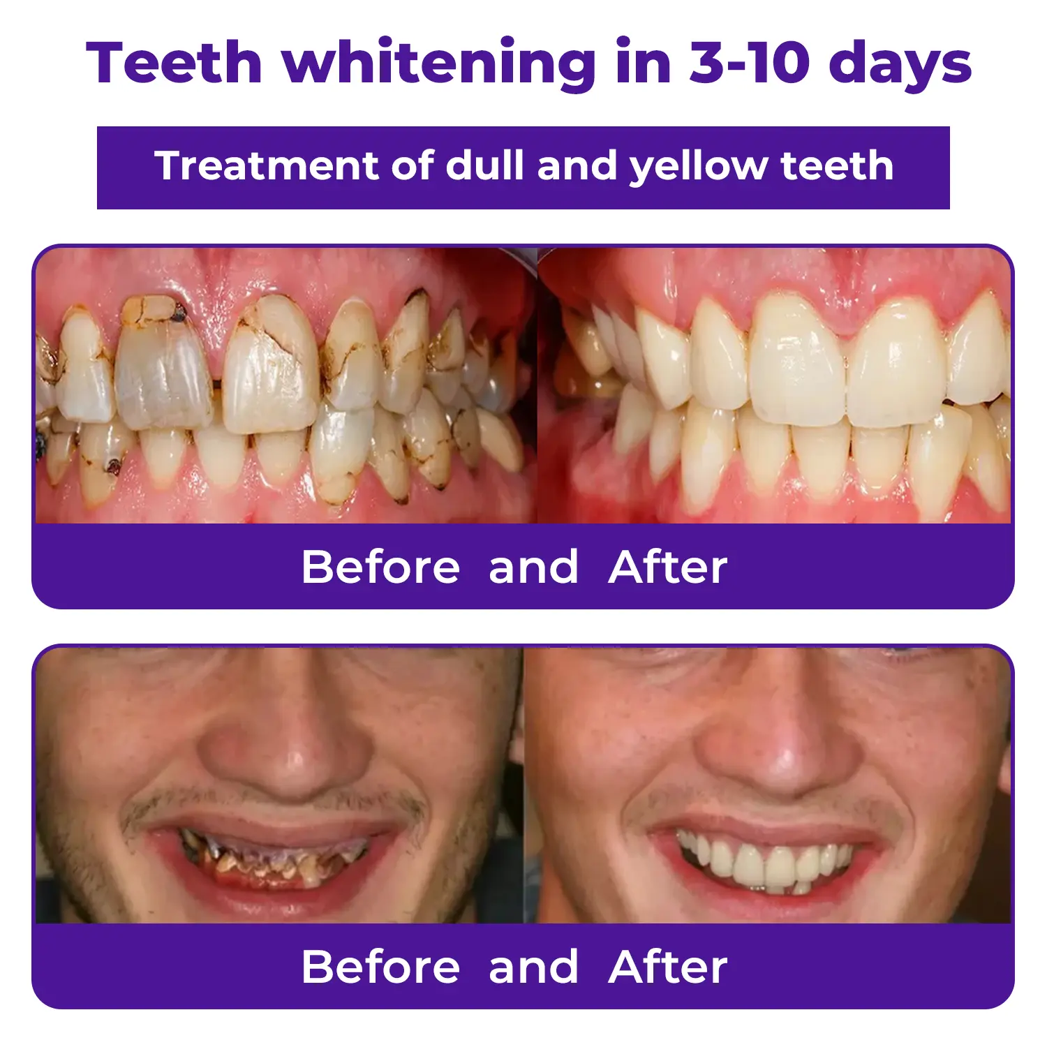 🦷Dobshow® Dental Repair Mineral Powder >> 🔥Buy 1 Get 1 Free🔥