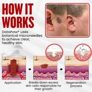 See Results in 3-5 Days with Dobshow® WartAway Pro Patches.