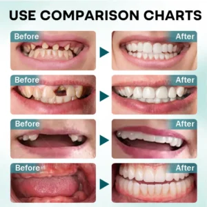 Dobshow® 𝐅𝐢𝐫𝐦𝐇𝐨𝐥𝐝 𝐃𝐞𝐧𝐭𝐮𝐫𝐞 𝐀𝐝𝐡𝐞𝐬𝐢𝐯𝐞