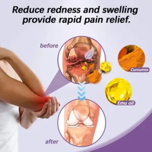 👨‍⚕️New research results | Dobshow® SynoJoint  Synergy Gel with Turmeric & Emu Oil