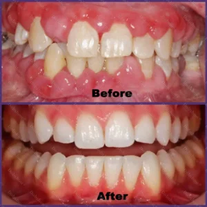 🐝 Dobshow® ApiCore BeeVenom Vital Repair Toothpaste