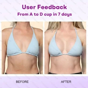 ๐U.S. ๐๐๐๐๐๐๐๐ก ๐๐ฉ๐ค๐ง๐ | Dobshowยฎ Natural Breast Enhancement Oil for Lift & Firming