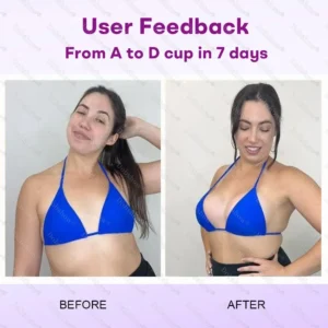 ๐U.S. ๐๐๐๐๐๐๐๐ก ๐๐ฉ๐ค๐ง๐ | Dobshowยฎ Natural Breast Enhancement Oil for Lift & Firming