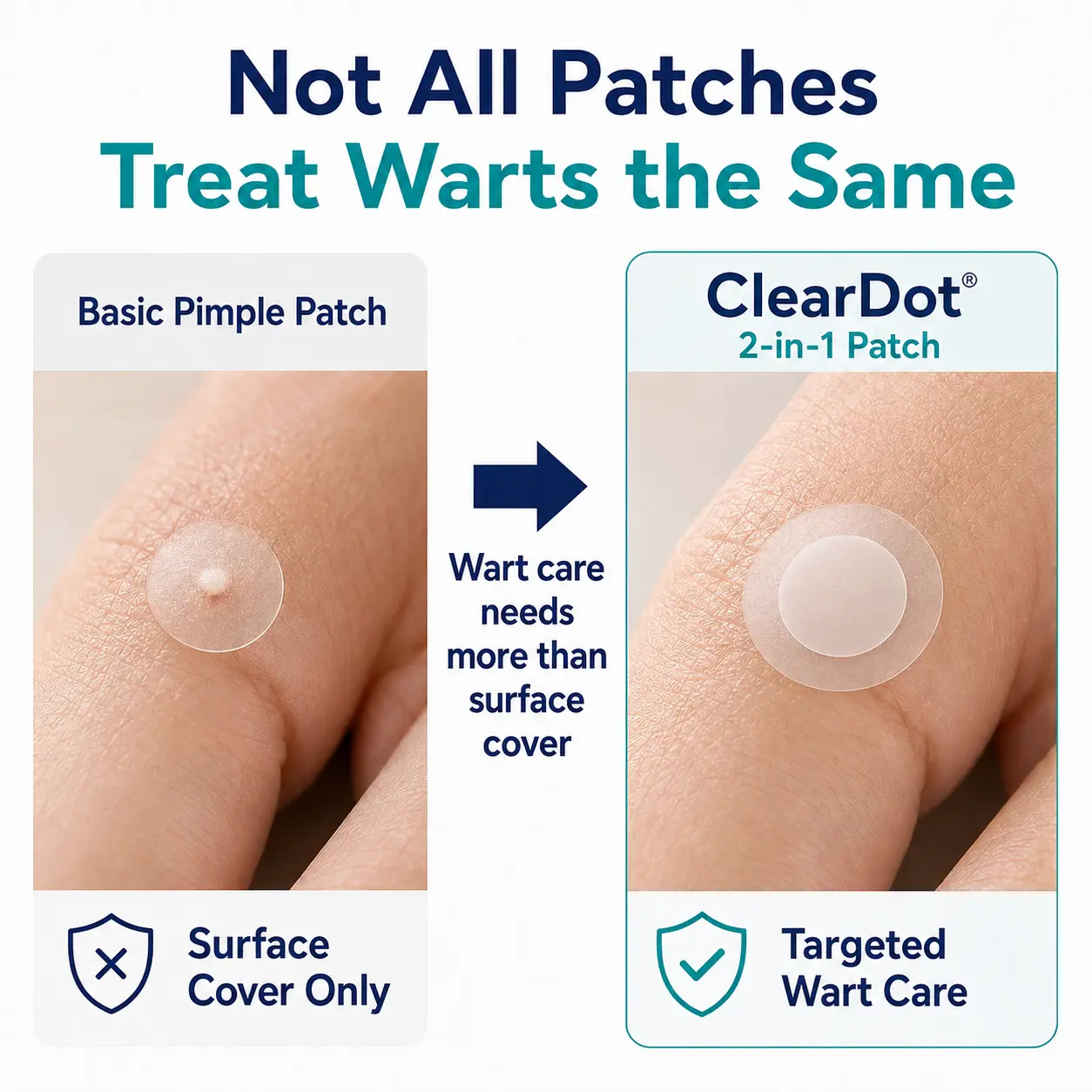 ⚡Dobshow®ClearDot 2-in-1 Patch | Helps Smooth Raised Bumps, Blemishes & Uneven Skin Texture