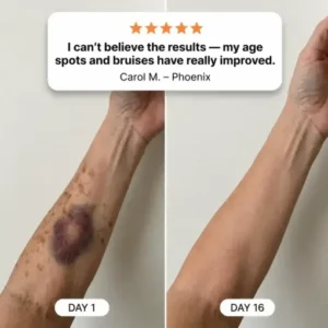 Dobshow®The Soft Dark Spot & Bruise Repair Cream