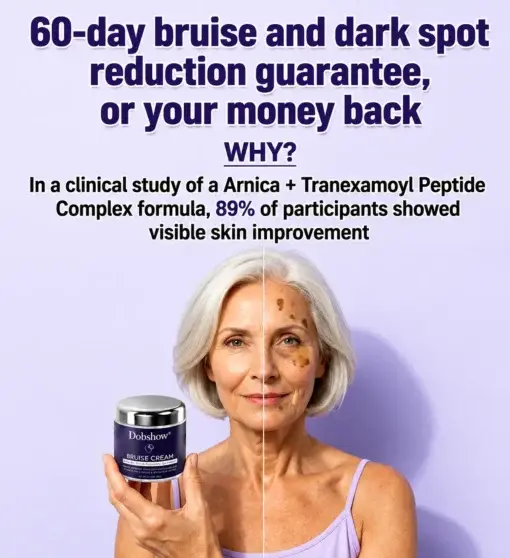 Dobshow®The Soft Dark Spot & Bruise Repair Cream