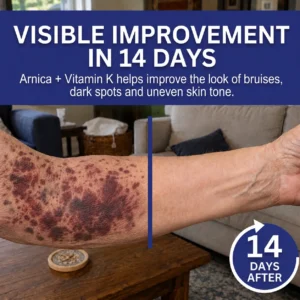 🏆𝐎𝐟𝐟𝐢𝐜𝐢𝐚𝐥 𝐔𝐒 𝐒𝐭𝐨𝐫𝐞🎉Over 100K+ Sold🔥 Dobshow® All-New Upgraded Dark Spot Correcting, Bruise Healing & Skin Strengthening Cream✨