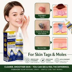 🔥 78K+ Sold! Dobshow® ✨ 2-in-1 Cryo-Cooling Bump Renewal Spray ☘️ Targets Skin Tags, Common Warts & Rough Bumps | Helps Improve the Look of Uneven, Rough Skin | Fast-Drying Formula for Face & Body