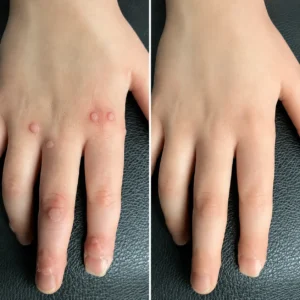 🔥 78K+ Sold! Dobshow® ✨ 2-in-1 Cryo-Cooling Bump Renewal Spray ☘️ Targets Skin Tags, Common Warts & Rough Bumps | Helps Improve the Look of Uneven, Rough Skin | Fast-Drying Formula for Face & Body