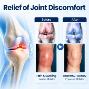 100K+ SOLD 🔥 Dobshow® ArthriNAD+ Pro Advanced Joint Recovery Cream