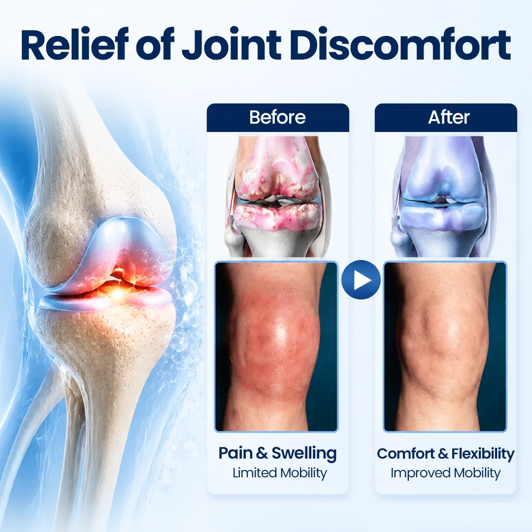 100K+ SOLD 🔥 Dobshow® ArthriNAD+ Pro Advanced Joint Recovery Cream