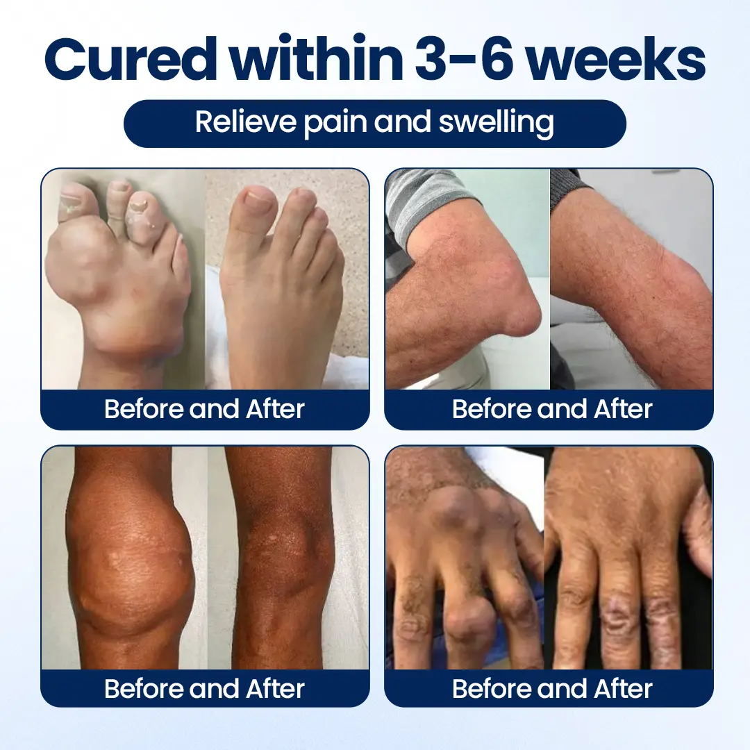100K+ SOLD 🔥 Dobshow® ArthriNAD+ Pro Advanced Joint Recovery Cream
