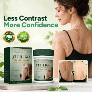 100K+ SOLD 🔥 Dobshow® Herbal Vitiligo Cream