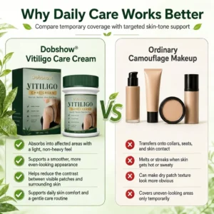 100K+ SOLD 🔥 Dobshow® Herbal Vitiligo Cream