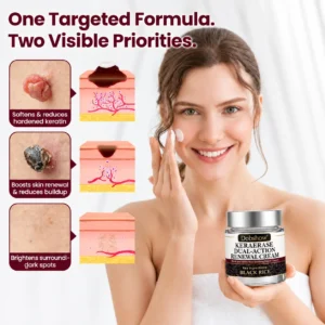100K+ SOLD 🔥 Dobshow® KeraErase Dual-Action Renewal Cream (New Formula)
