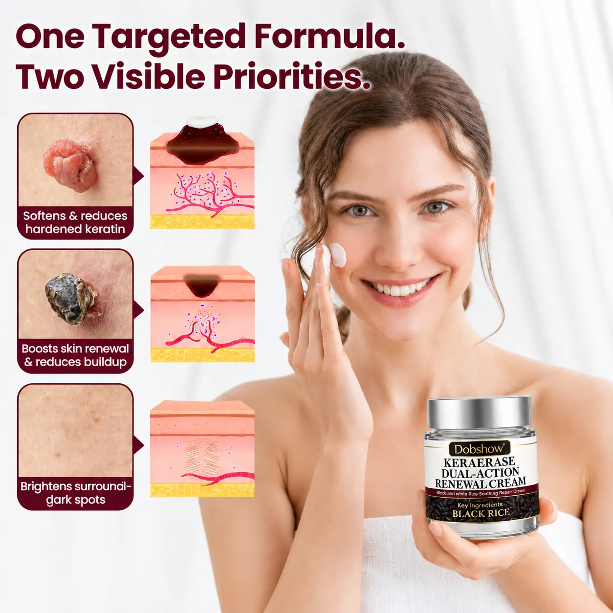 100K+ SOLD 🔥 Dobshow® KeraErase Dual-Action Renewal Cream (New Formula)