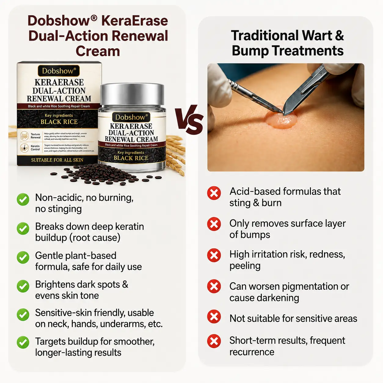 100K+ SOLD 🔥 Dobshow® KeraErase Dual-Action Renewal Cream (New Formula)