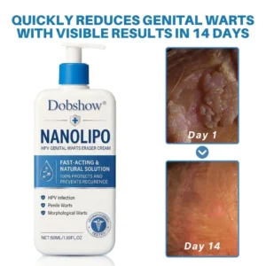 100K+ SOLD 🔥 Dobshow®    NanoLipo H-P-V Intimate Renewal Cream