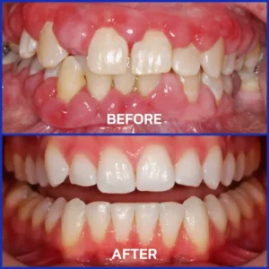 100K+ SOLD 🔥 Dobshow® VioCore Bee Venom Dental Treatment Toothpaste