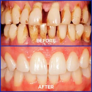 100K+ SOLD 🔥 Dobshow® VioCore Bee Venom Dental Treatment Toothpaste
