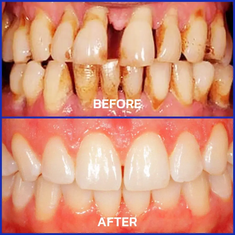 100K+ SOLD 🔥 Dobshow® VioCore Bee Venom Dental Treatment Toothpaste