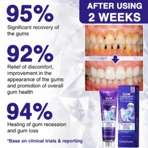 100K+ SOLD 🔥 Dobshow® VioCore Bee Venom Dental Treatment Toothpaste