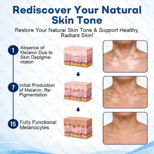 🔥100K+ SOLD | Dobshow® Advanced Piperine Vitiligo Repigmentation Spray — Upgraded Steroid-Free Botanical Formula