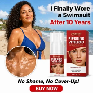 🔥100K+ SOLD | Dobshow® Advanced Piperine Vitiligo Repigmentation Spray — Upgraded Steroid-Free Botanical Formula