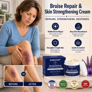 💥300K+ SOLD💕- Dobshow® Bruise Shield & Skin-Strengthening Cream