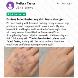💥300K+ SOLD💕- Dobshow® Bruise Shield & Skin-Strengthening Cream