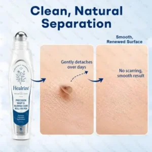 Dobshow® 7-Day Blemish Remover Pain-Free & Scar-Free Advanced Roller Pen for Skin Tags and Spots
