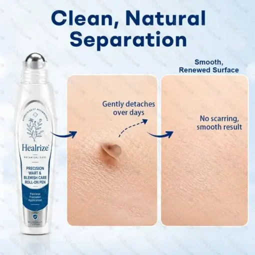 Dobshow® 7-Day Blemish Remover Pain-Free & Scar-Free Advanced Roller Pen for Skin Tags and Spots