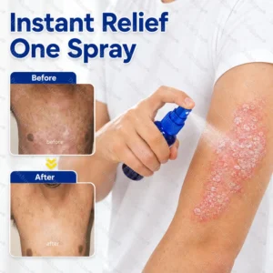 Dobshow® Advanced Psoriasis Relief Spray