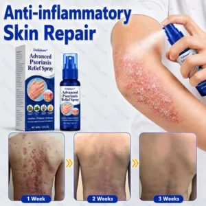 Dobshow® Advanced Psoriasis Relief Spray