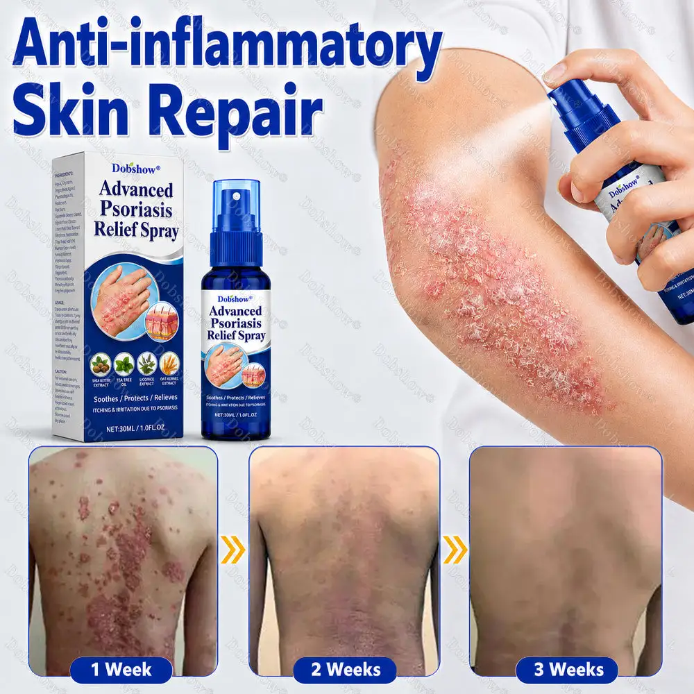 Dobshow® Advanced Psoriasis Relief Spray