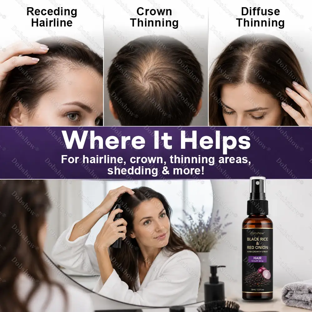 🔥Dobshow® Black Rice & Red Onion Hair Growth Spray