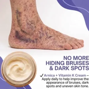 Dobshow® Dark Spot & Bruise Recovery Cream