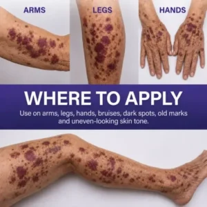 Dobshow® Dark Spot & Bruise Recovery Cream