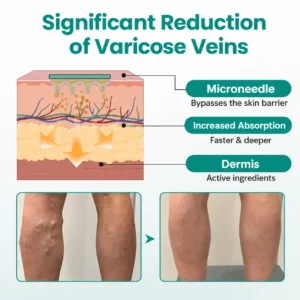 Dobshow® LegRenew Varicose Vein Patch
