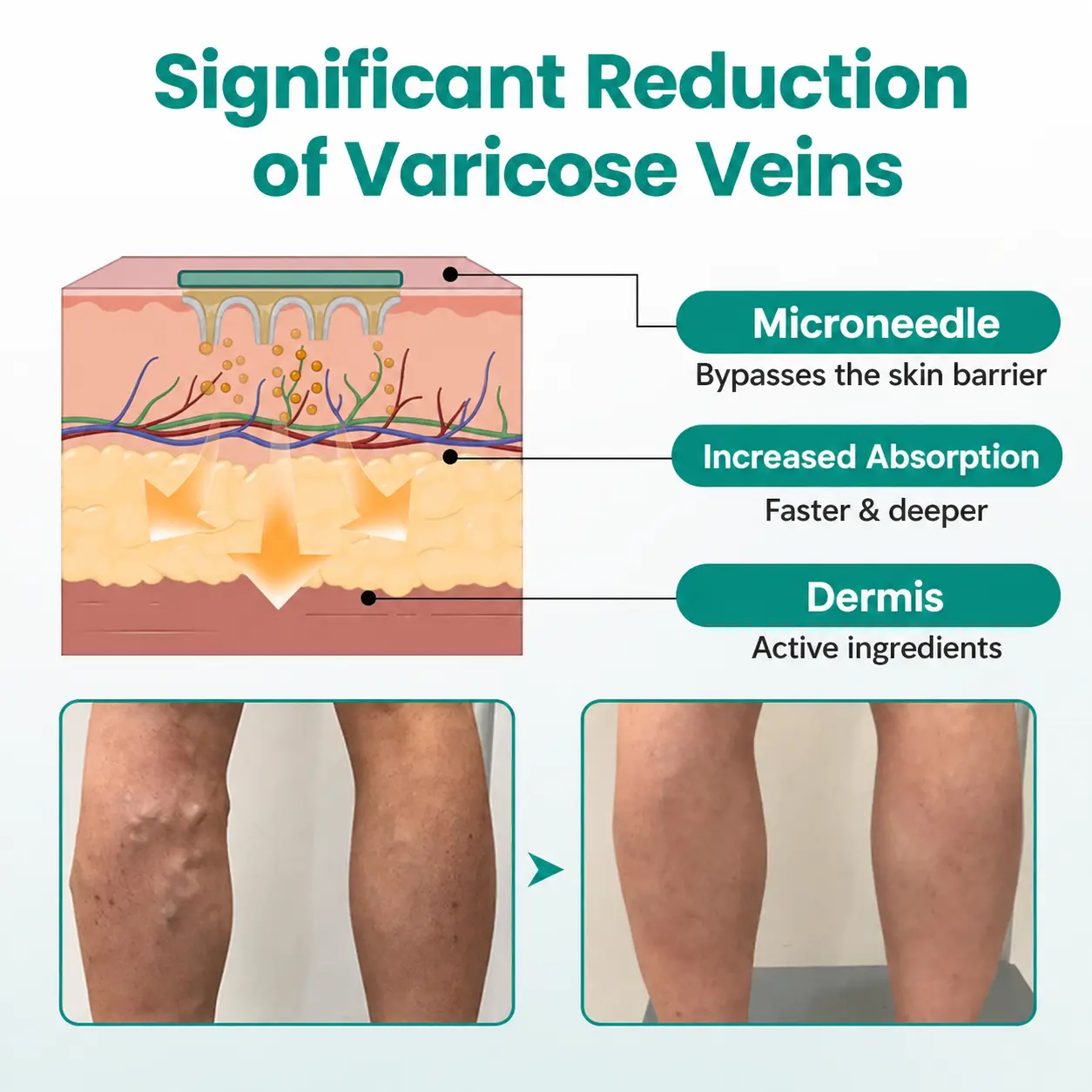 Dobshow® LegRenew Varicose Vein Patch