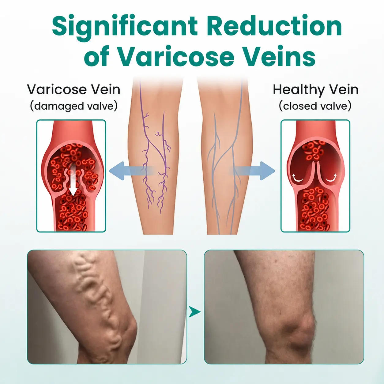 Dobshow® LegRenew Varicose Vein Patch