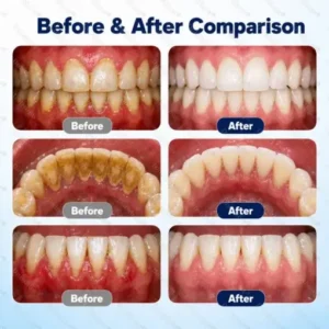Dobshow® Lipo-Gum™ Advanced Repair Drops