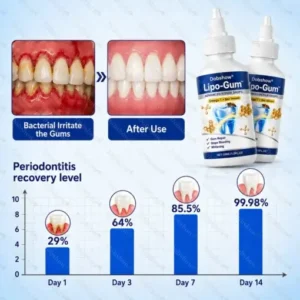 Dobshow® Lipo-Gum™ Advanced Repair Drops