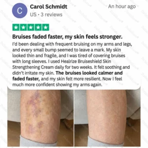 OFFICIAL
BRAND
🔥Dobshow® BRUISESHIELD Skin Strengthening Cream