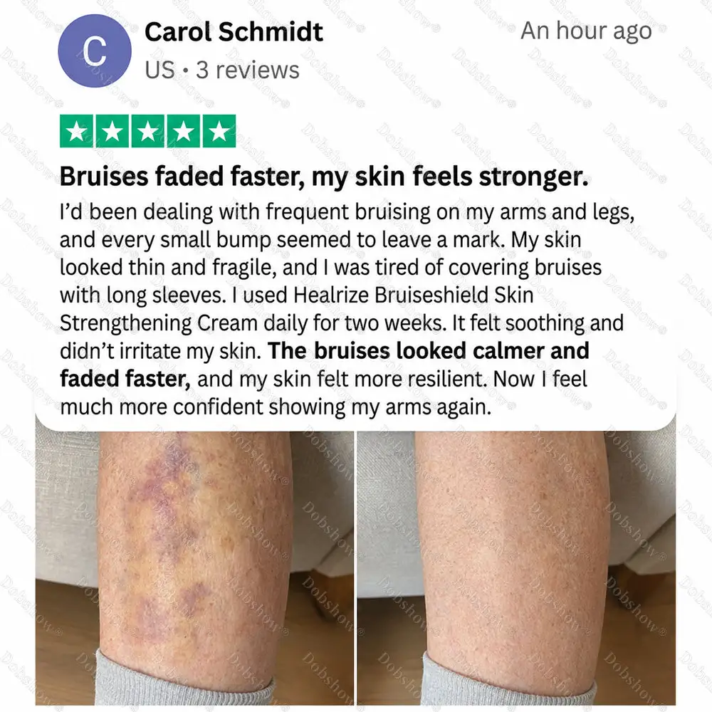 OFFICIAL
BRAND
🔥Dobshow® BRUISESHIELD Skin Strengthening Cream