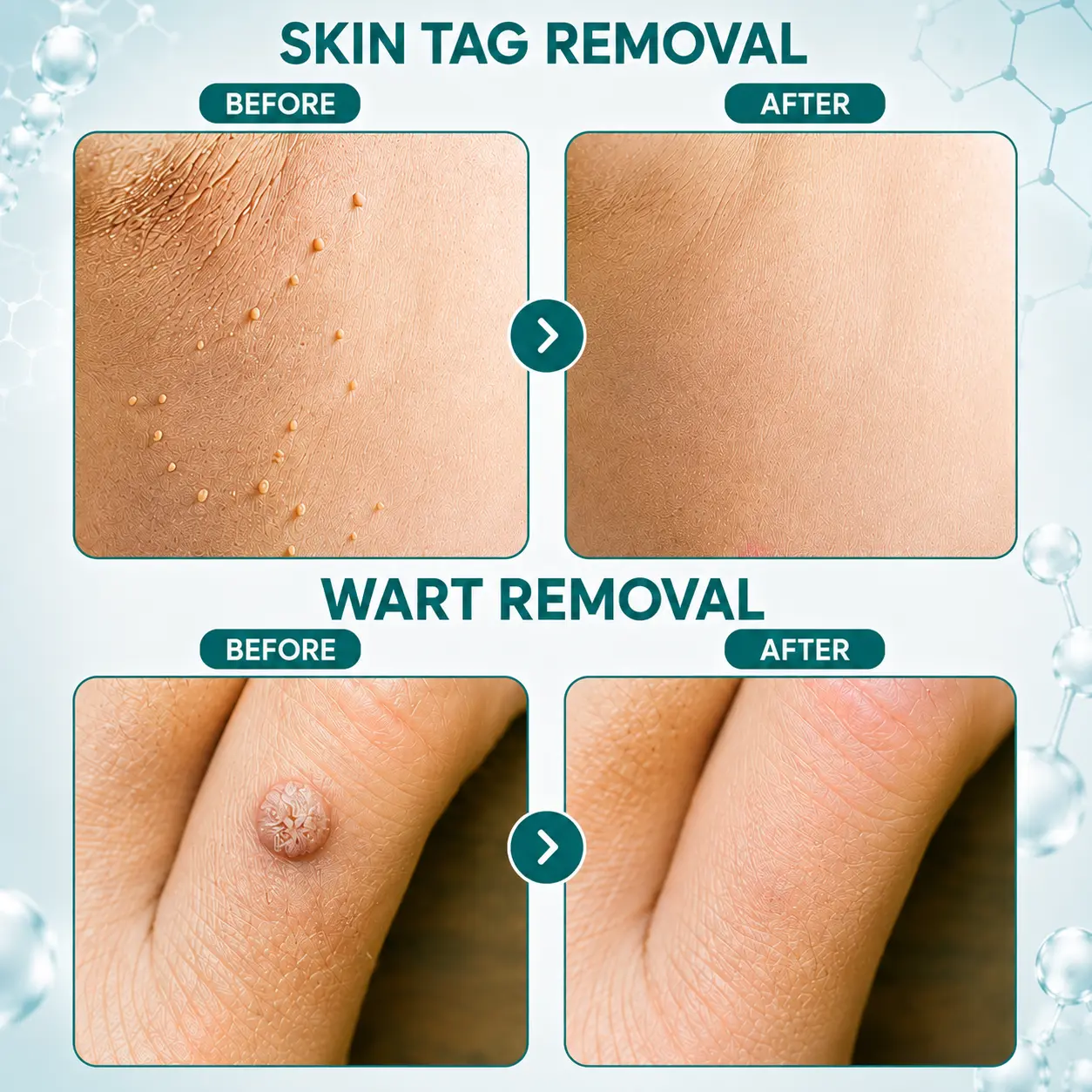 OFFICIAL
BRAND
✨Dobshow® Blemish Clear Microneedle Patches🩹🩹