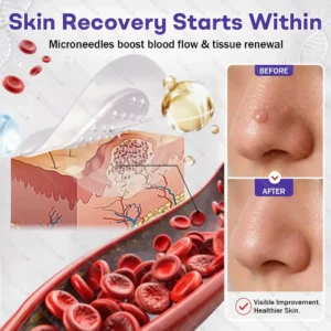 OFFICIAL
BRAND
Dobshow® Wart and mole removal microneedle patch